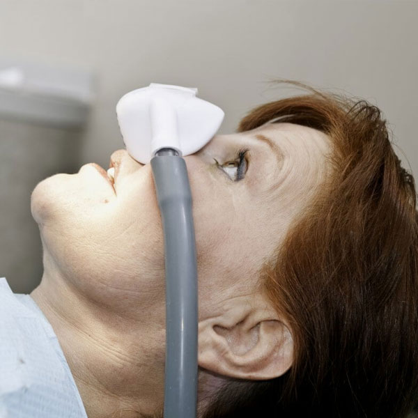 Laughing gas sedation